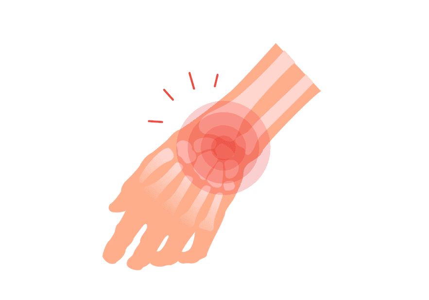 Sore Wrists and Cycling Altius Healthcare